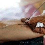 Close up of the Hand and Needle of Ajarn Kob of Ayuttaya - Photo by Dan White (R.I.P.)