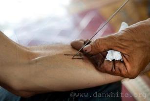 Close up of the Hand and Needle of Ajarn Kob of Ayuttaya - Photo by Dan White (R.I.P.). www.danwhite.org this photo source; https://www.facebook.com/photo.php?fbid=331739163582647&set=pb.100730283350204.-2207520000.1349882329&type=1&theater